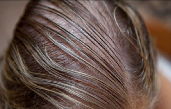 Làm thế nào để tóc mọc dày hơn? – Đây là bí quyết!