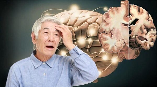 tác dụng của nghệ vàng và mật ong: Giảm nguy cơ mắc Alzheimer