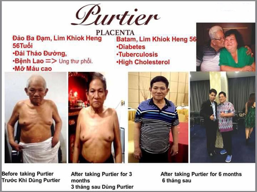 Cách Nhận Biết Tế Bào Gốc Nhau Thai Hưu CHÍNH HÃNG Purtier Placenta 7th Edition Phiên bản 7, Thế Hệ 7, Đời thứ 7 CAM KẾT HÀNG THẬT (Mua 1 Tặng 1)