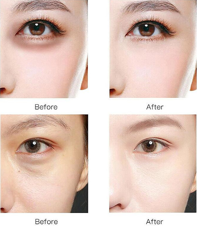 Bộ 60 Mặt Nạ Mắt Images Chiết Xuất Collagen Và Tảo Đỏ Chống Nếp Nếp Nhăn Và Quầng Thâm Hiệu Quả 80g MS6047