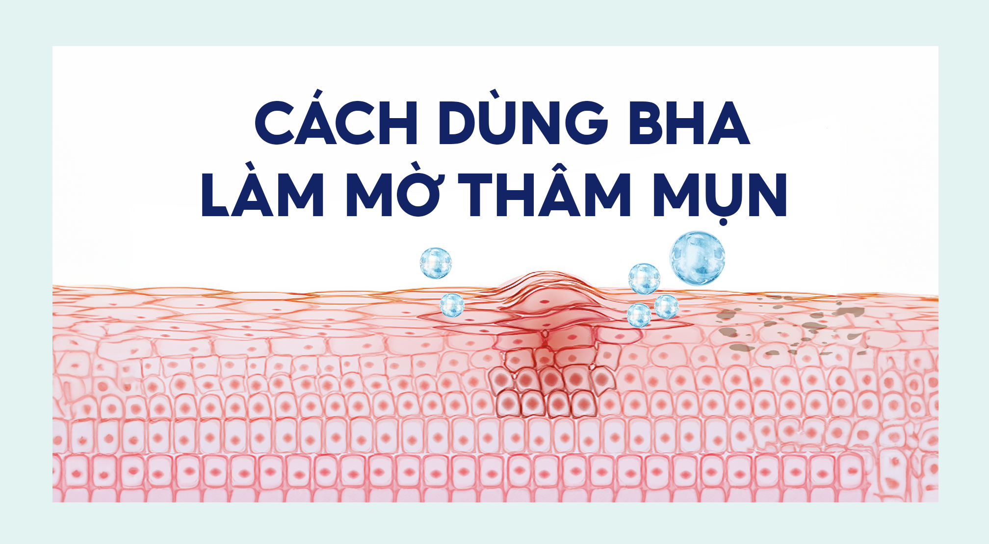 Cách dùng BHA làm mờ thâm mụn