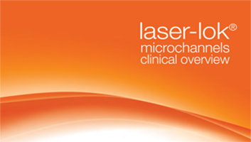 Nghiên cứu về Laser-lok trên Implant