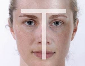 Làn da hỗn hợp có sự khác nhau về loại da giữa vùng chữ T và 2 má