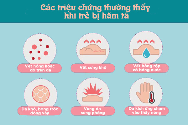 Các triệu chứng thường thấy khi trẻ bị hăm tã