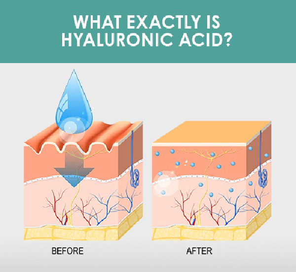 Hyaluronic acid có khả năng khôi phục độ ẩm và độ mềm cho da bị tổn thương