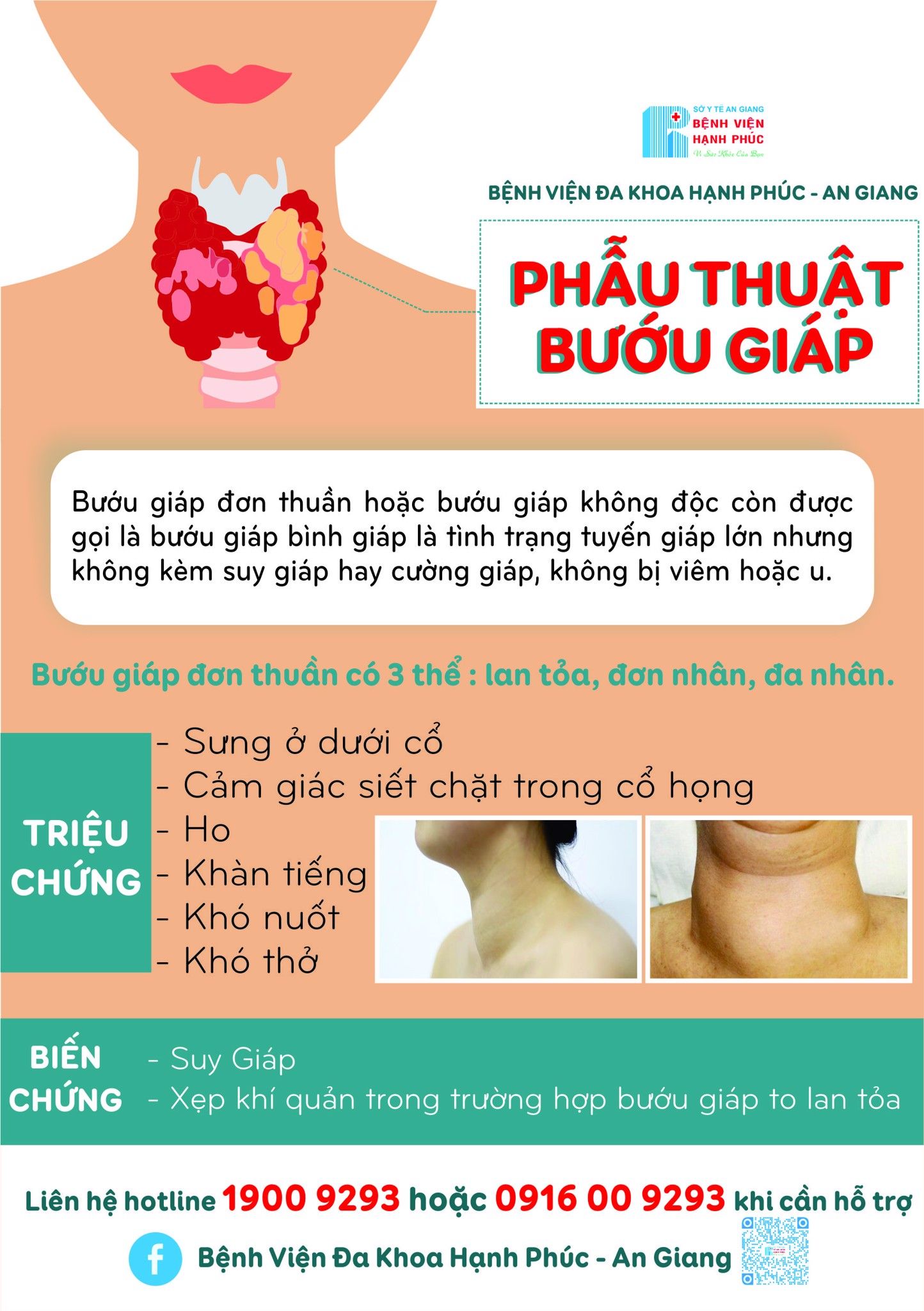 PHẪU THUẬT BƯỚU GIÁP