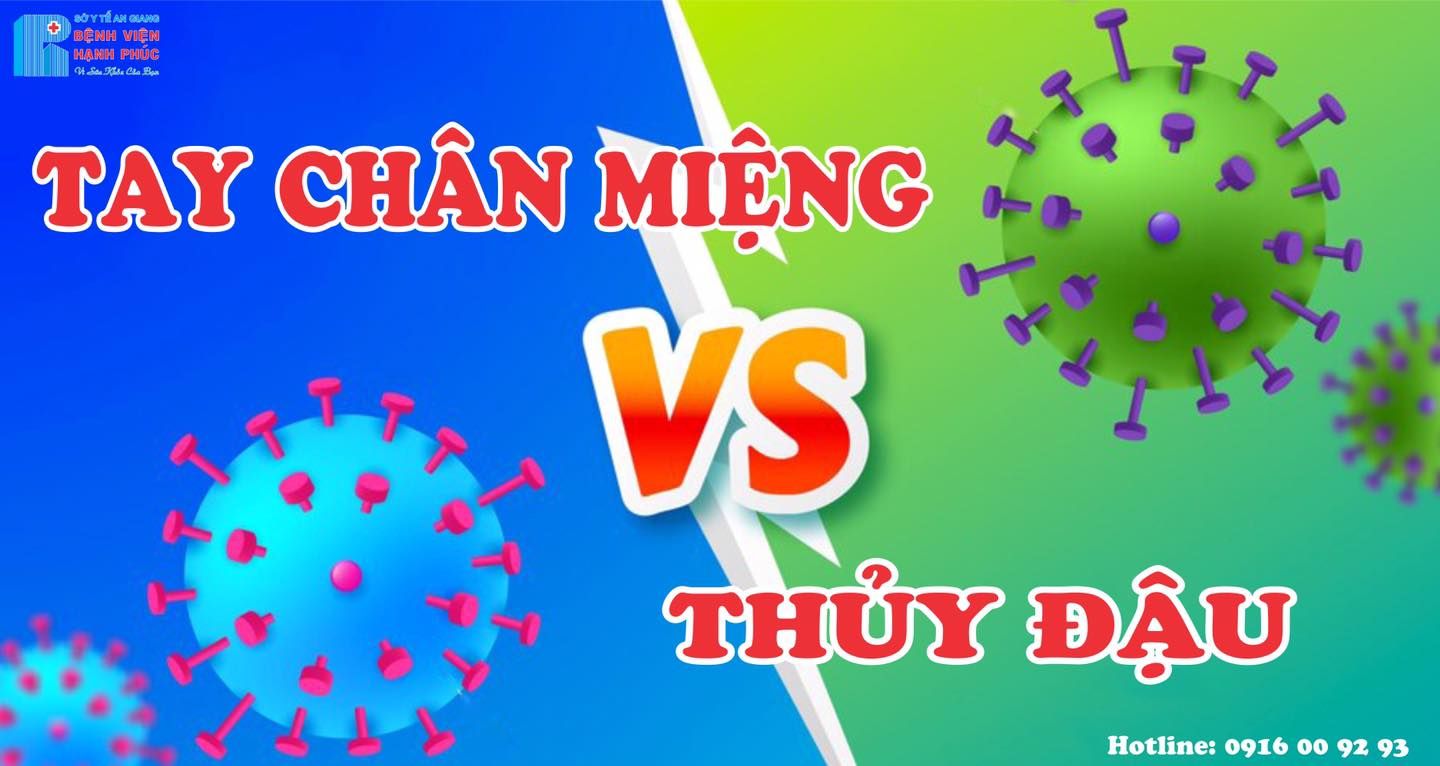 PHÂN BIỆT NỐT BAN THUỶ ĐẬU VÀ TAY CHÂN MIỆNG