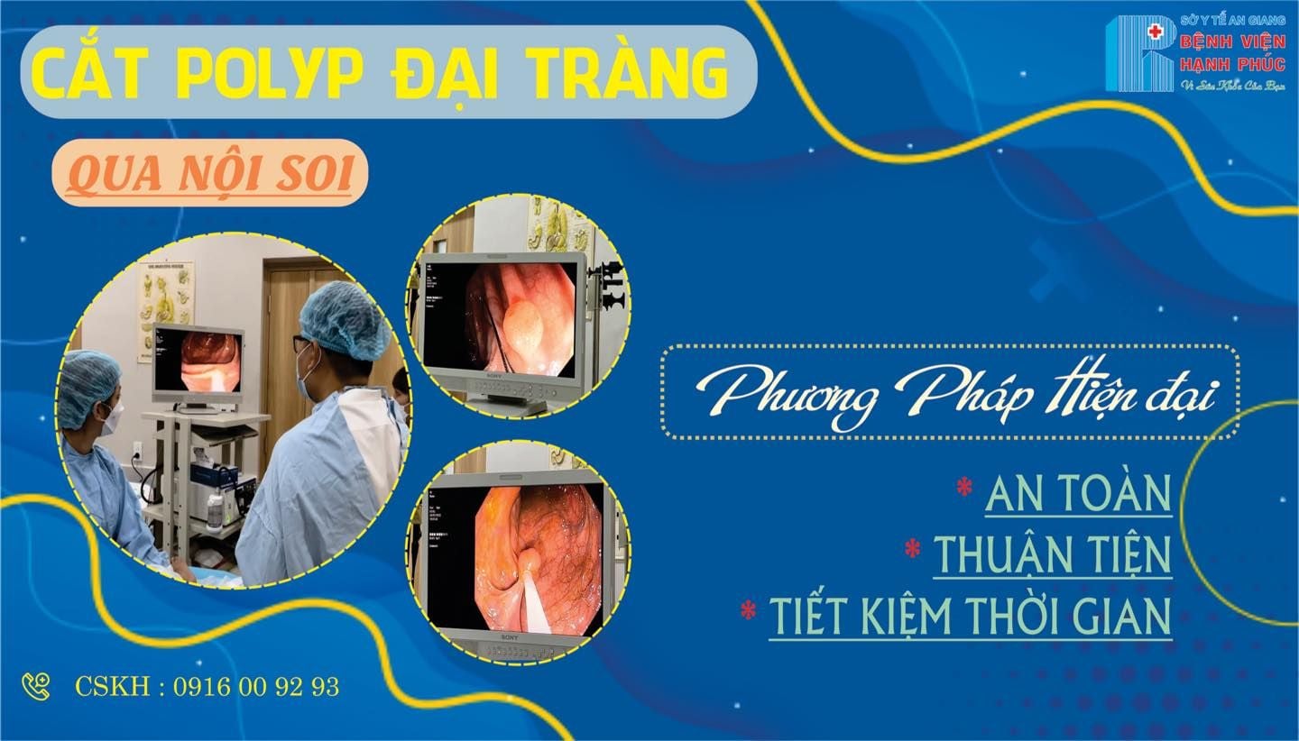 CẮT POLYP ĐẠI TRÀNG QUA NỘI SOI - PHƯƠNG PHÁP HIỆN ĐẠI VỚI NHIỀU ƯU ĐIỂM VƯỢT TRỘI