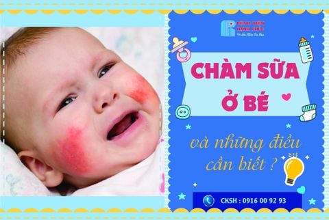 CHÀM SỮA Ở BÉ VÀ NHỮNG ĐIỀU CẦN BIẾT ?