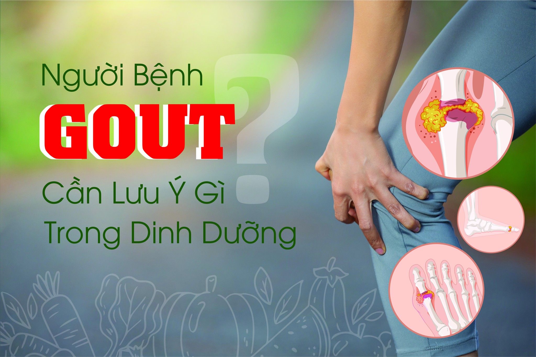 NGƯỜI BỆNH GOUT CẦN LƯU Ý GÌ TRONG CHẾ ĐỘ DINH DƯỠNG?