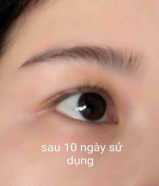 sự thay đổi sau 10 ngày sử dụng