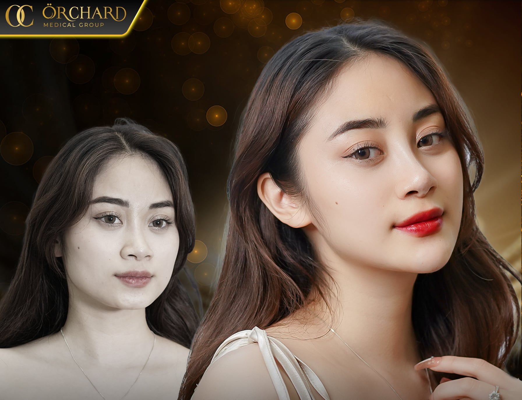 Feedback khách hàng về dịch vụ mũi chỉ tại Orchard