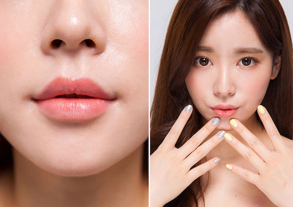 Tiêm filler môi bị sưng bao lâu?