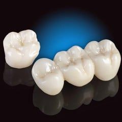 price of porcelain crowns