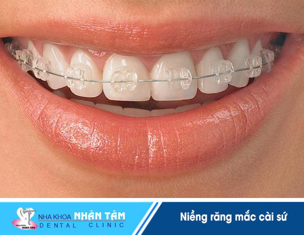 nieng rang mac cai su