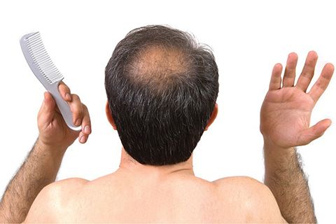 52 tuổi, bị bạc tóc từ năm 25 tuổi thì dùng Ô Mộc Khang có hiệu quả không?