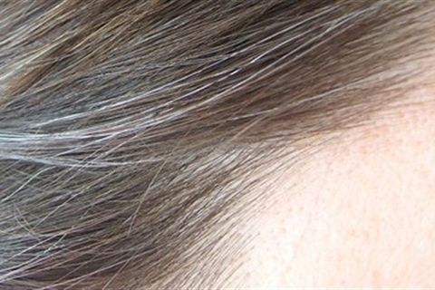 Bạc tóc có liên quan gì đến thiếu ngủ không?