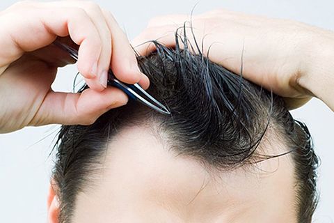 5 nguy hại khôn lường từ thói quen nhổ tóc bạc