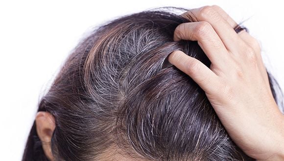 Cẩn thận nếu đầu tóc bạn xuất hiện 6 dấu hiệu này: Bết, thưa, rụng hay bạc  sớm không đáng sợ bằng điều này
