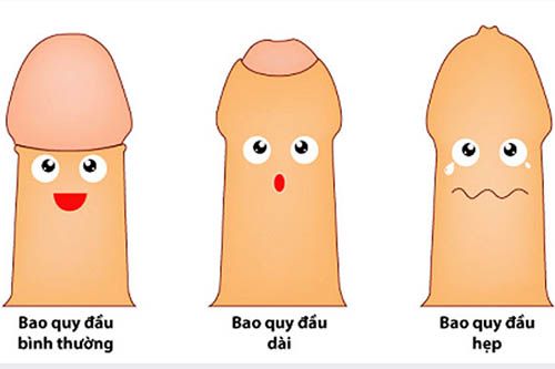 Khi Nào Nên Cắt Và Không Nên Cắt Bao Quy Đầu (Hẹp - Thừa)