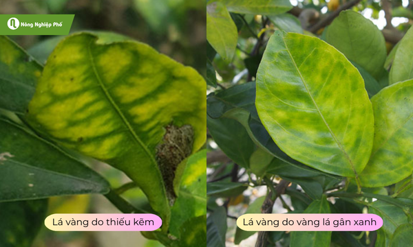 Hai loại bệnh có điểm khác riêng biệt, nhưng cũng dễ nhầm lẫn