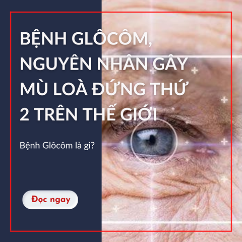 BỆNH GLÔCÔM, NGUYÊN NHÂN GÂY MÙ LOÀ ĐỨNG THỨ 2 TRÊN THẾ GIỚI