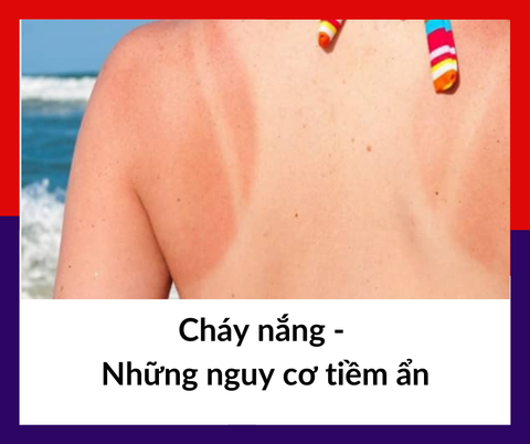 Cháy nắng - Những nguy cơ tiềm ẩn| Wellbeing