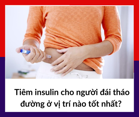 Tiêm insulin cho người đái tháo đường ở vị trí nào tốt nhất? | Wellbeing