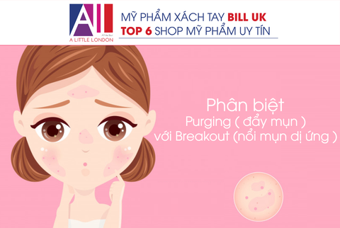 Topic 64 : PHÂN BIỆT PURGING VỚI BREAKOUT