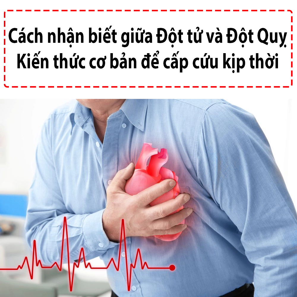 Phân biệt giữa đột tủ và đột quỵ
