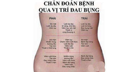 Đoán Bệnh Qua Vị Trí Đau Bụng, Mọi Người Cần Biết