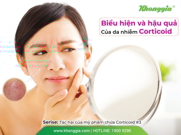 BIỂU HIỆN CỦA DA NHIỄM CORTICOID.
