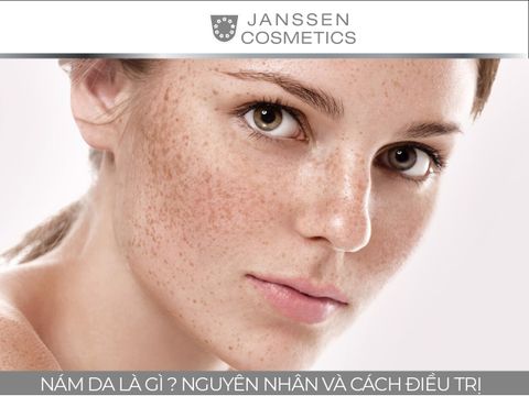 NÁM DA LÀ GÌ ? NGUYÊN NHÂN VÀ CÁCH ĐIỀU TRỊ