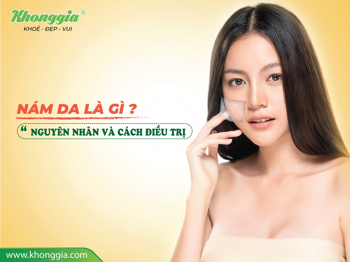 NÁM DA LÀ GÌ ? NGUYÊN NHÂN VÀ CÁCH ĐIỀU TRỊ