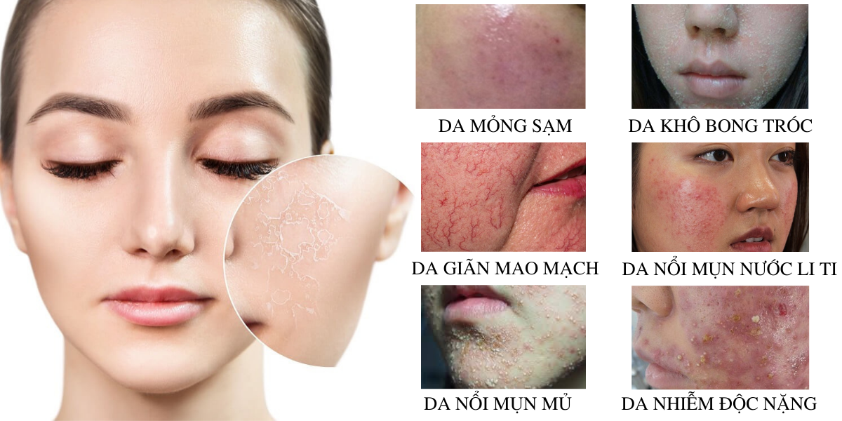 Trường hợp cần phải phục hồi làn da càng sớm càng tốt.