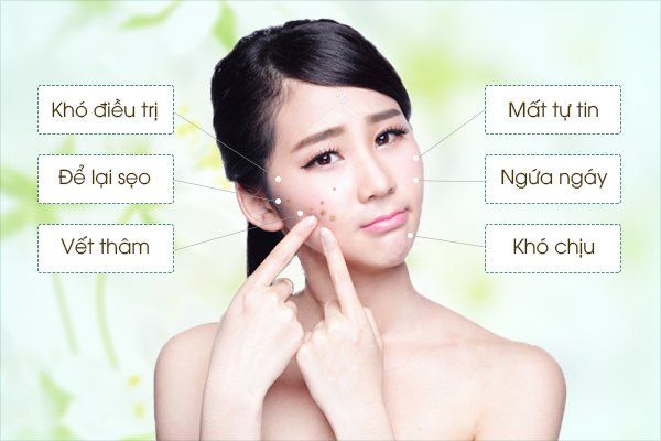 Mụn gây ra những hậu quả như thế nào đến cuộc sống ?