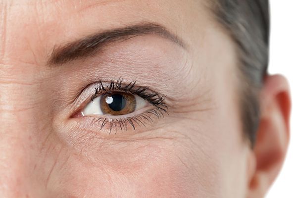 Nheo mắt thường xuyên khiến mắt dễ xuất hiện nếp nhăn là nỗi khổ dưỡng da của nàng U3 - Hapydy us