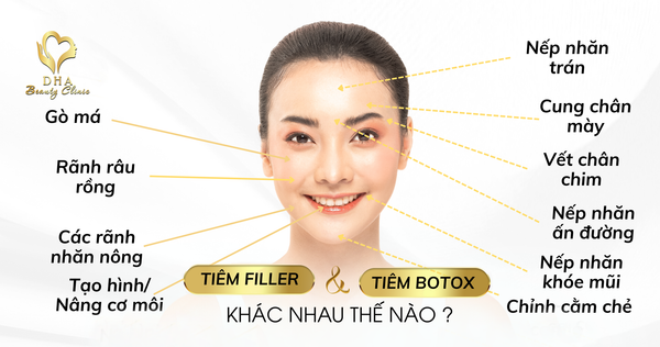 SỰ KHÁC NHAU GIỮA TIÊM FILLER VÀ BOTOX