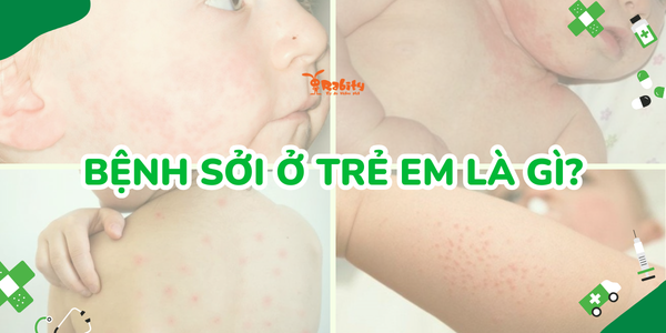 Bệnh sởi ở trẻ em là gì?