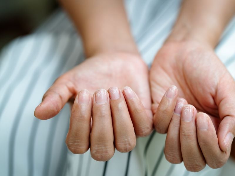 7 thói quen hàng ngày làm hỏng móng tay mà bạn nên tránh