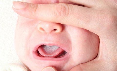 Tổng hợp cách để lấy rơ lưỡi cho bé dưới 12 tháng tuổi