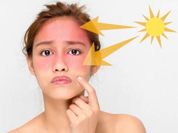 Thường xuyên tiếp xúc với tia UV là nguyên nhân chính gây ung thư da