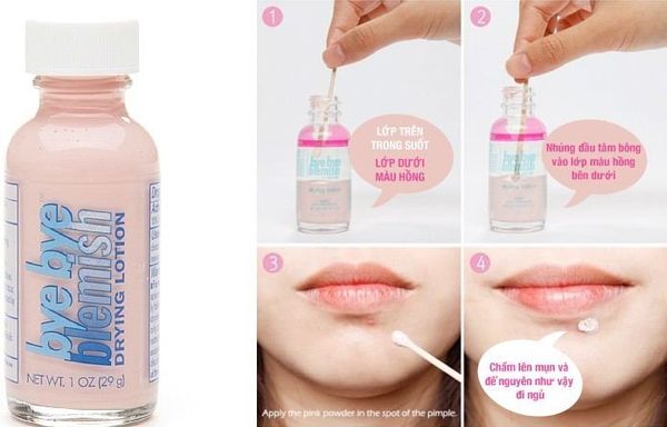 chấm mụn bye bye blemish