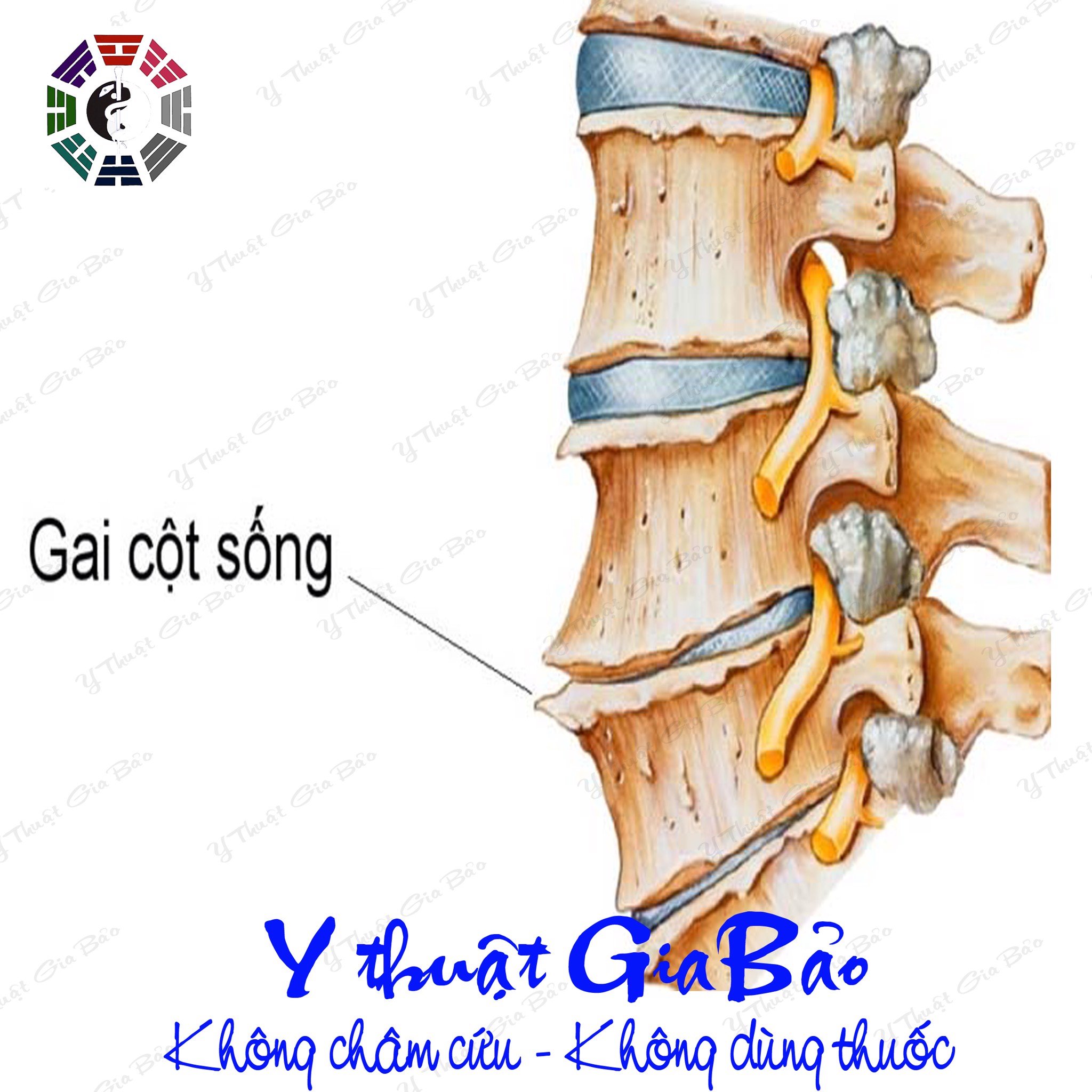 Gai cột sống nên ăn gì kiêng gì