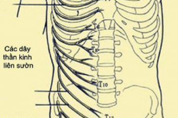 chữa đau thần kinh liên sườn