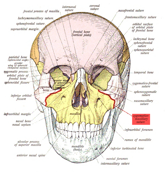 Nắn chỉnh hạ xương gò má