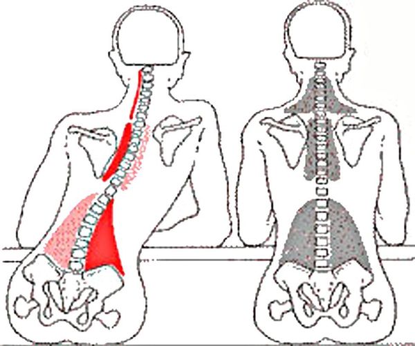 9 biểu hiện sai lệch cơ thể