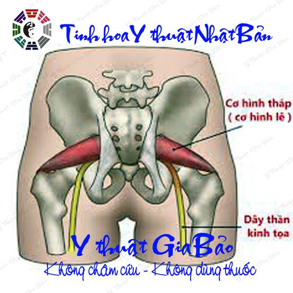 chữa đau lưng mông cơ hình lê hội chứng piriformis