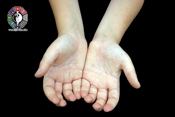 Lòng bàn tay trắng nhợt là biểu hiện của suy nhược cơ thể nghiêm trọng