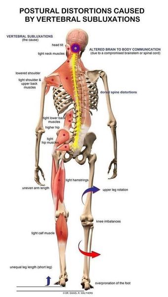 9 biểu hiện sai lệch cơ thể